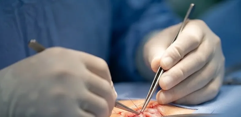 Ozamiz Gets a New Healthcare Story as Filipino-American Doctors Bring Free Surgeries and Medical Care to Misamis Occidental